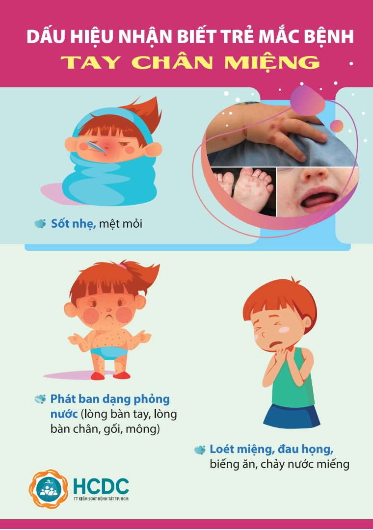 Mụn nước bàn tay